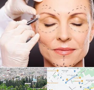 دکتر زیبایی صورت در محلاتی شیراز 