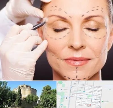 دکتر زیبایی صورت در مرداویج اصفهان 