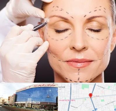 دکتر زیبایی صورت در نصف راه تبریز
