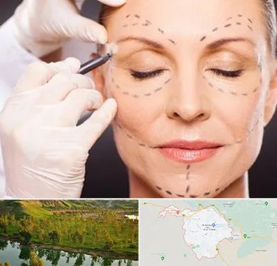 دکتر زیبایی صورت در بهبهان