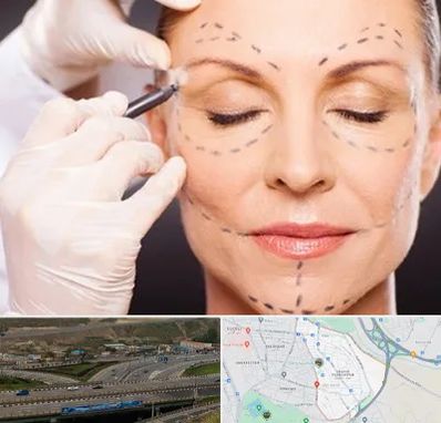 دکتر زیبایی صورت در یاغچیان تبریز