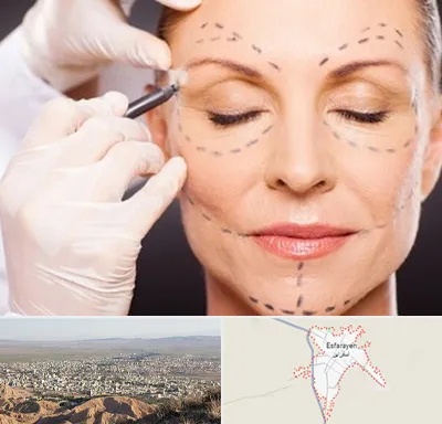 دکتر زیبایی صورت در اسفراین