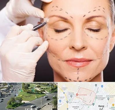 دکتر زیبایی صورت در شاهین ویلا کرج 