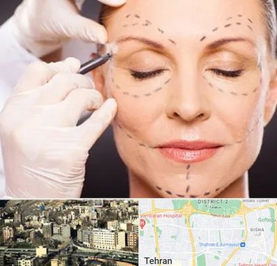 دکتر زیبایی صورت در مرزداران 