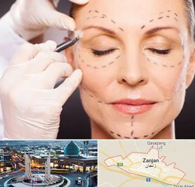 دکتر زیبایی صورت در زنجان