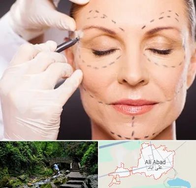 دکتر زیبایی صورت در علی آباد کتول