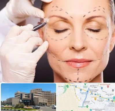 دکتر زیبایی صورت در صیاد شیرازی مشهد 