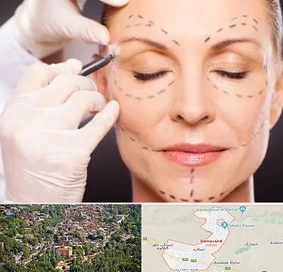 دکتر زیبایی صورت در دماوند