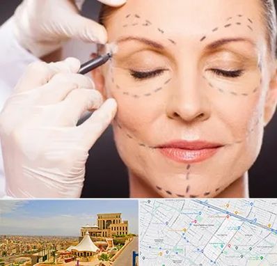 دکتر زیبایی صورت در هاشمیه مشهد 