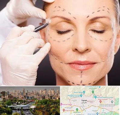 دکتر زیبایی صورت در منطقه 1 تهران 