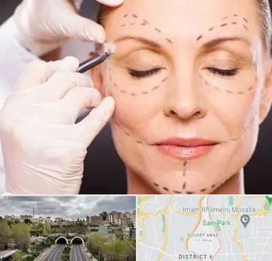 دکتر زیبایی صورت در یوسف آباد 