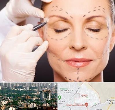 دکتر زیبایی صورت در عظیمیه کرج 