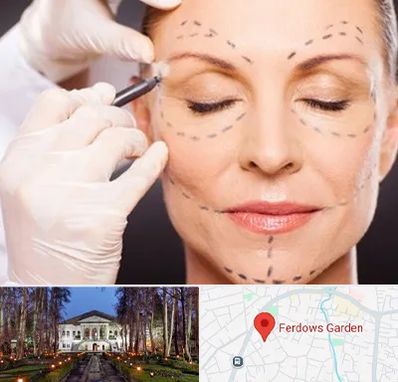 دکتر زیبایی صورت در باغ فردوس