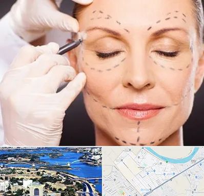 دکتر زیبایی صورت در کوروش اهواز 