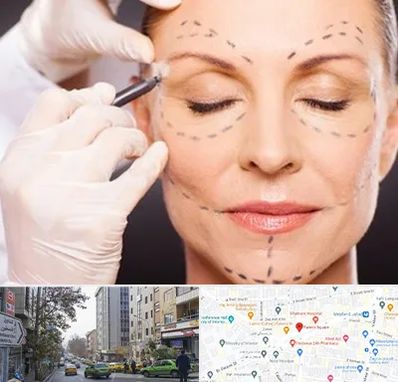 دکتر زیبایی صورت در فاطمی 