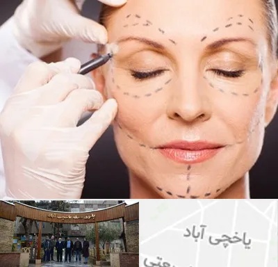 دکتر زیبایی صورت در یاخچی آباد