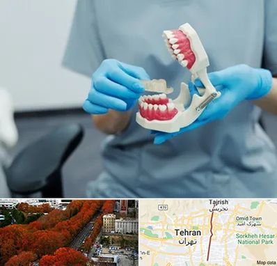 دندانپزشک خانم در ولیعصر 