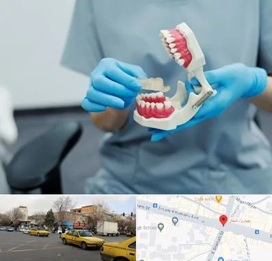 دندانپزشک خانم در شهناز تبریز