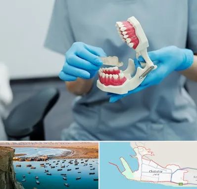 دندانپزشک خانم در چابهار