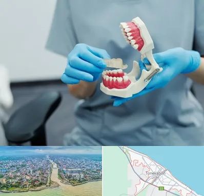 دندانپزشک خانم در تنکابن