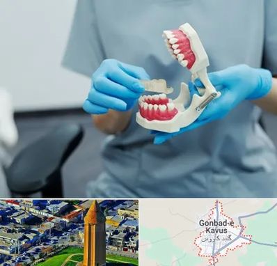 دندانپزشک خانم در گنبد کاووس