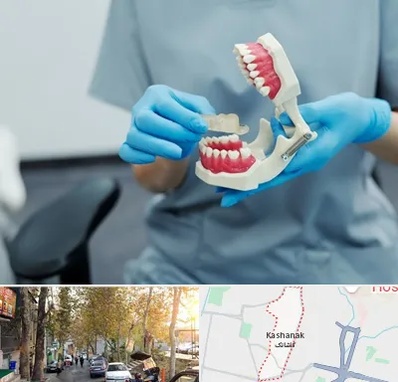 دندانپزشک خانم در کاشانک