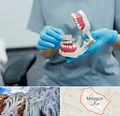 دندانپزشک خانم در میگون