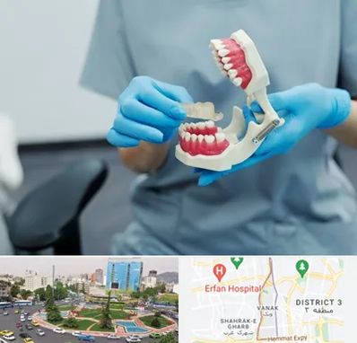 دندانپزشک خانم در ونک 