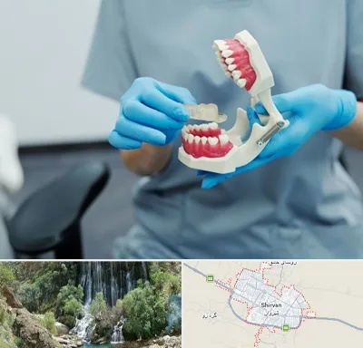 دندانپزشک خانم در شیروان
