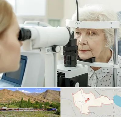 چشم پزشک خانم در خاش