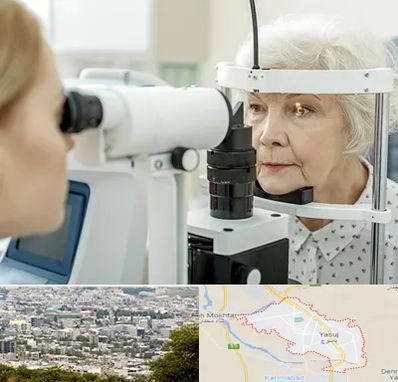 چشم پزشک خانم در یاسوج