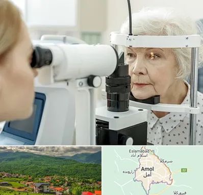 چشم پزشک خانم در آمل