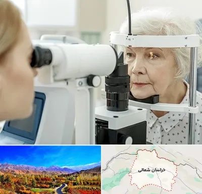 چشم پزشک خانم در خراسان شمالی