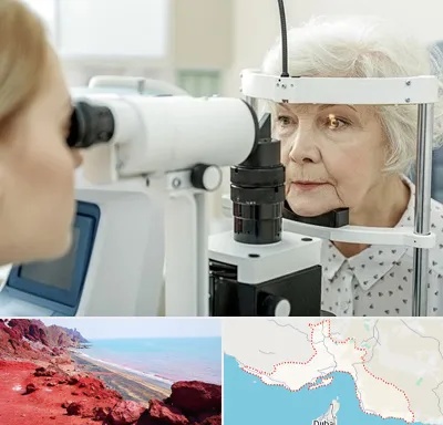 چشم پزشک خانم در هرمزگان