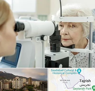 چشم پزشک خانم در زعفرانیه 