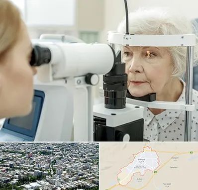 چشم پزشک خانم در شاهرود