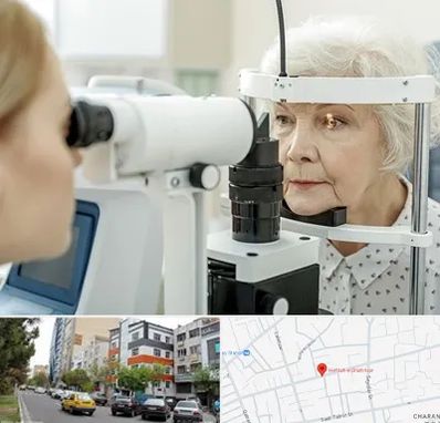 چشم پزشک خانم در هفده شهریور تبریز