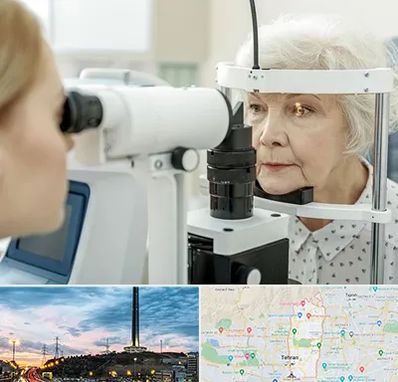 چشم پزشک خانم در منطقه 2 تهران 
