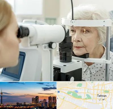 چشم پزشک خانم در غرب تهران 