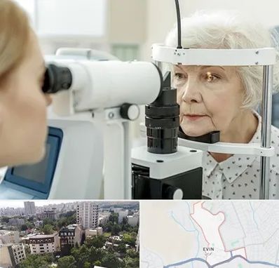 چشم پزشک خانم در اوین