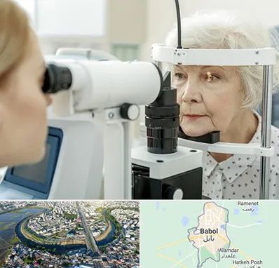 چشم پزشک خانم در بابل