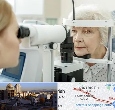 چشم پزشک خانم در فرمانیه 
