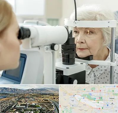 چشم پزشک خانم در منطقه 21 تهران 