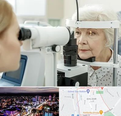 چشم پزشک خانم در گلسار رشت 