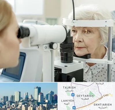 چشم پزشک خانم در قیطریه 