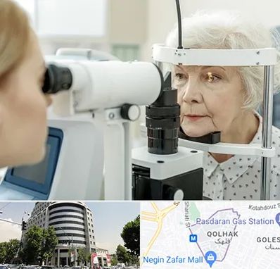 چشم پزشک خانم در قلهک 
