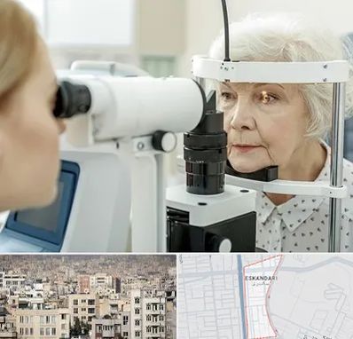 چشم پزشک خانم در اسکندری
