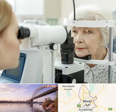 چشم پزشک خانم در اهواز