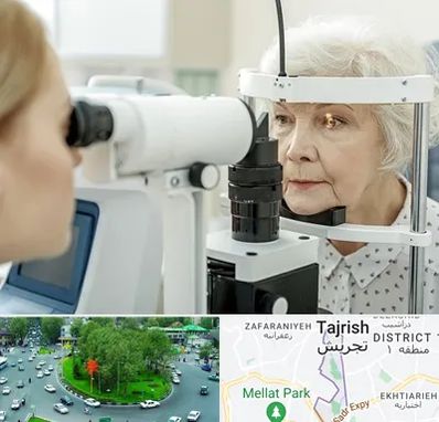 چشم پزشک خانم در تجریش 