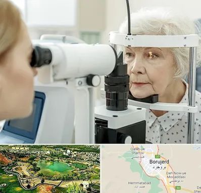 چشم پزشک خانم در بروجرد